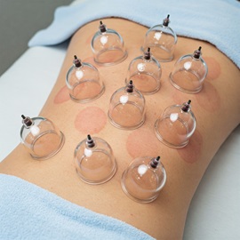 Traditional Cupping Therapy